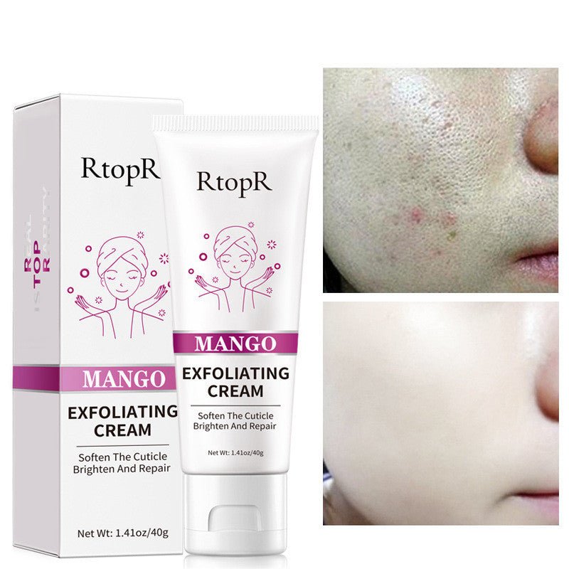RtopR Mango Exfoliating Gel Cream