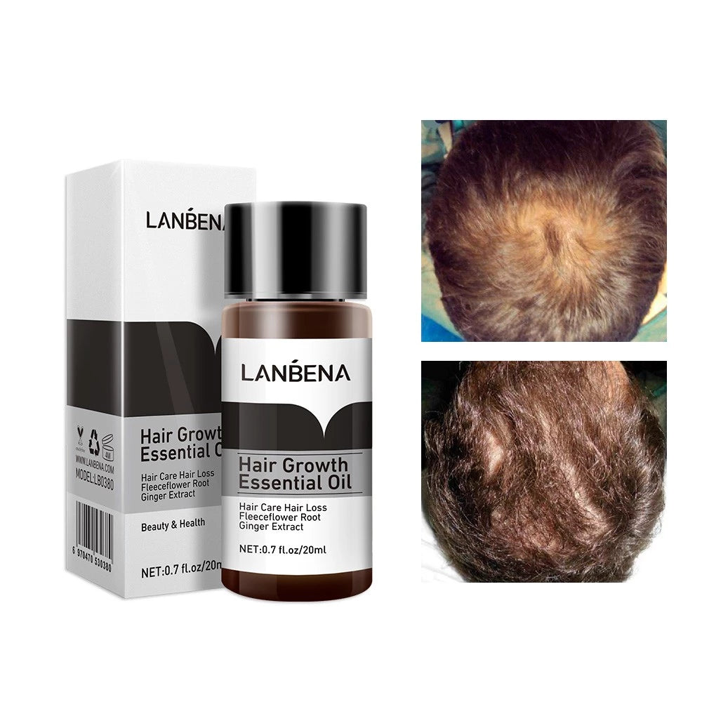 LANBENA Hair Care Essential Oil Hair Growth Treatment Prevention Hair Loss Treatment