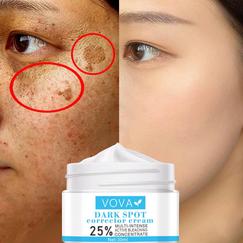 VOVA Effective Whitening Freckle Cream Remove Melasma Acne Spot Pigment Melanin Dark Spots Pigmentation Moisturizing Cream