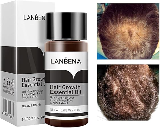 LANBENA Hair Care Essential Oil Hair Growth Treatment Prevention Hair Loss Treatment