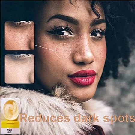 Brighten Skin Chinese Astragalus Face Whitening Cream