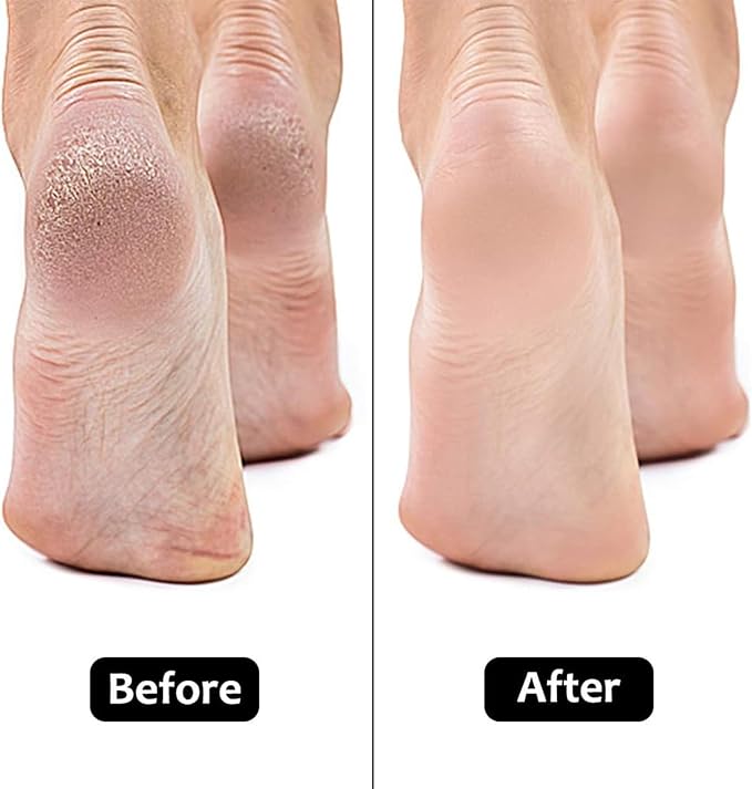 Electric Pedicure Foot Care Tool Files Pedicure Callus Remover