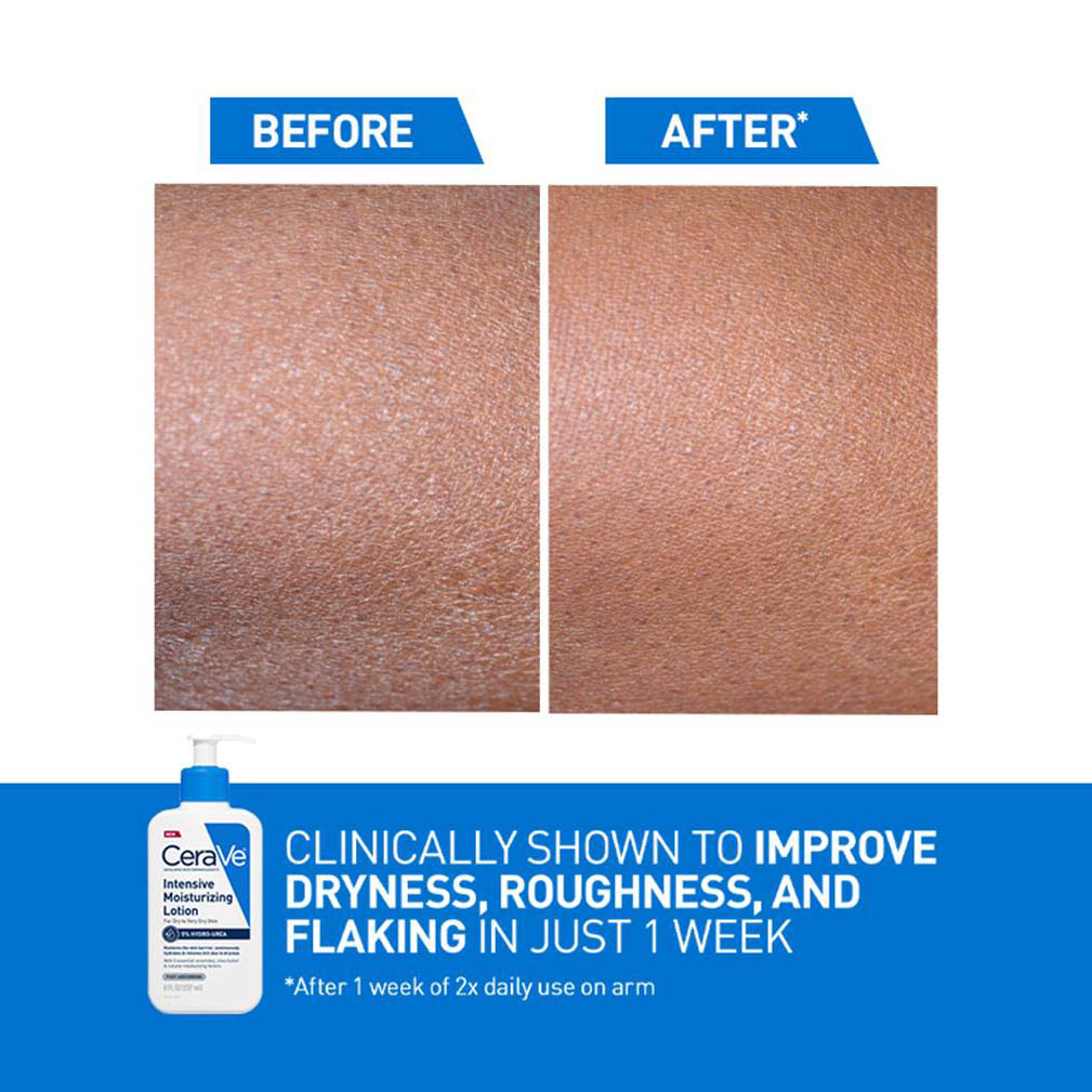 Cera Ve - Intensive Moisturizing Lotion