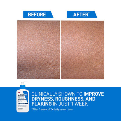 Cera Ve - Intensive Moisturizing Lotion