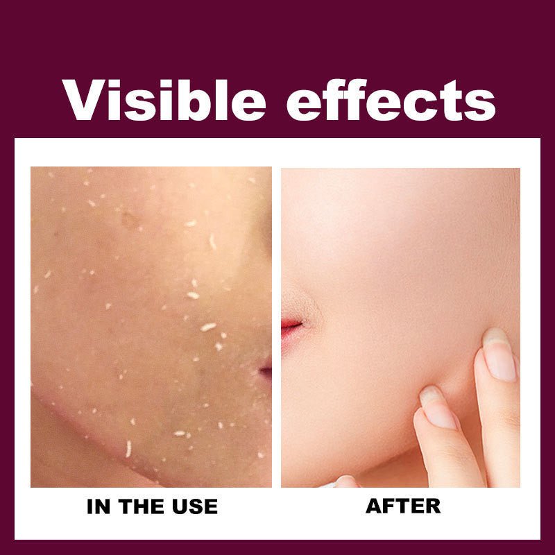 RtopR Mango Exfoliating Gel Cream