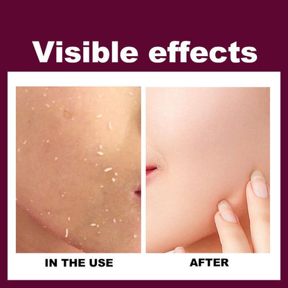 RtopR Mango Exfoliating Gel Cream