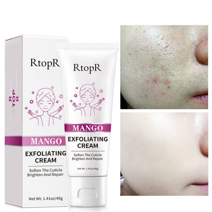 RtopR Mango Exfoliating Gel Cream