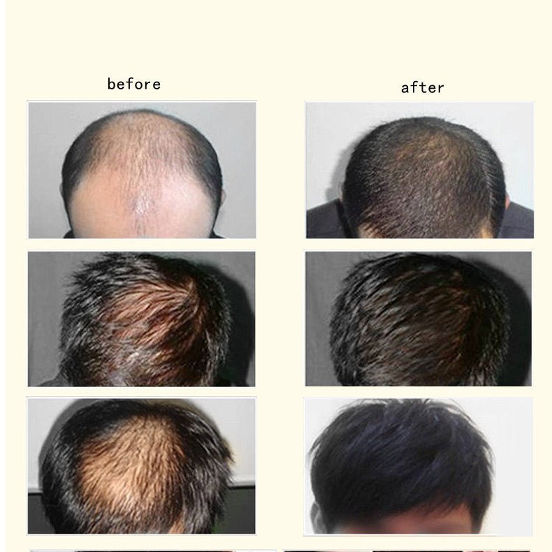 Natural Essence Ginger Anti-hair Loss Hair Maintenance