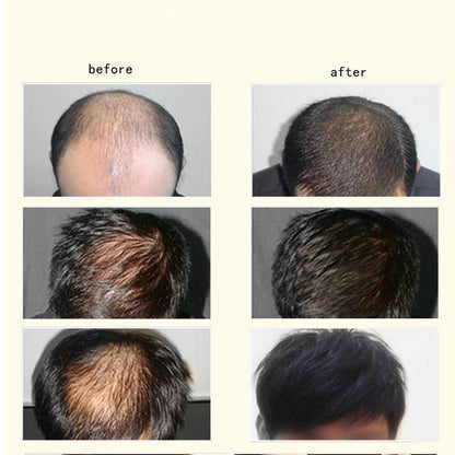 Natural Essence Ginger Anti-hair Loss Hair Maintenance