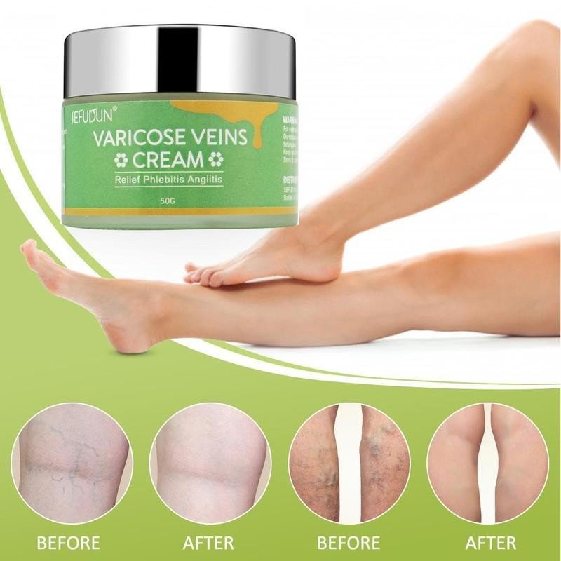 SEFUDUN Varicose Veins Cream Relief Phlebitis Angiitis 50g