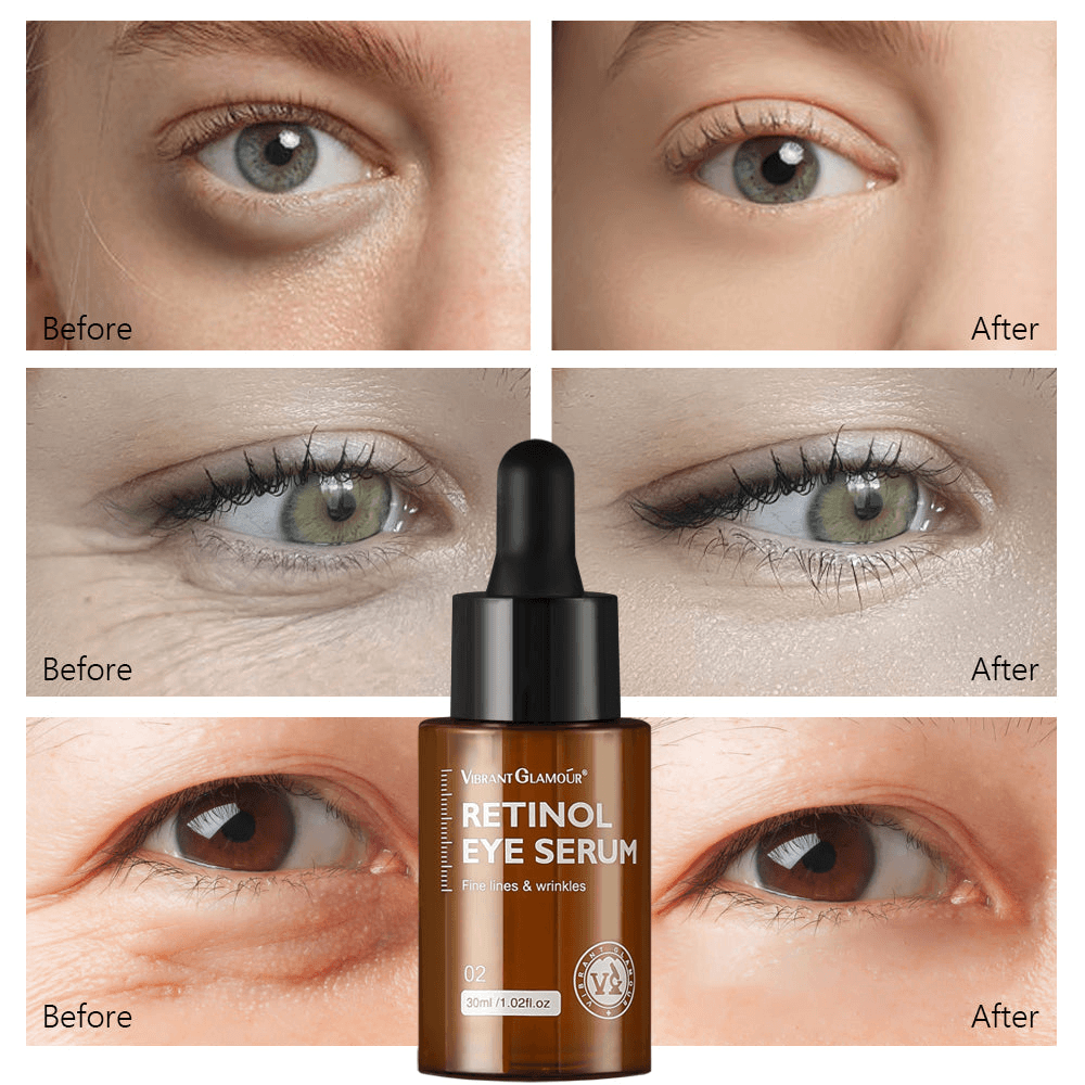 Retinol Eye Care Essence (Original)